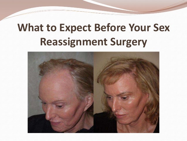 photo reassignment sex surgery Fake nude taylor swift pics